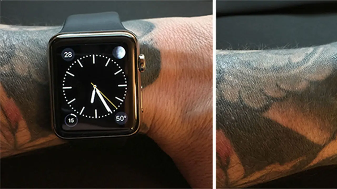 Apple Watch dövme sorunu nedir?