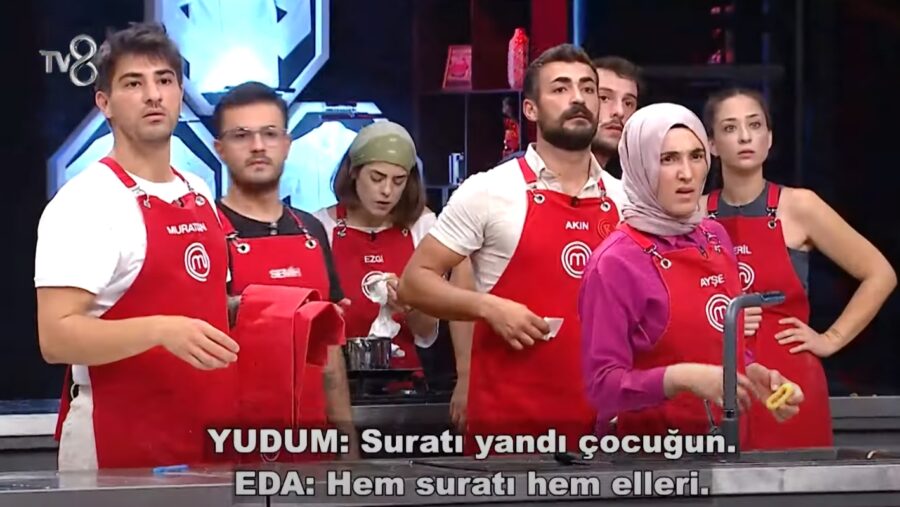 Masterchef Onur yüzü yandı