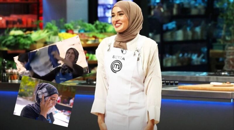 Masterchef Beyza'nın yüzünün son hali fotoğrafı