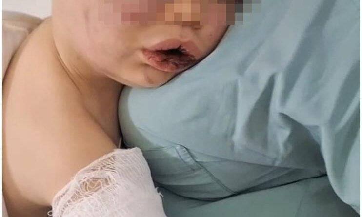 Darp sonucu hastanelik olan bebek devlet korumasına alınacak 1